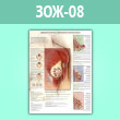 Плакат «Доброкачественные заболевания молочных желез» (ЗОЖ-08, ламинированная бумага, A2, 1 лист)